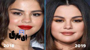 جراحی پلاستیک سلنا گومز