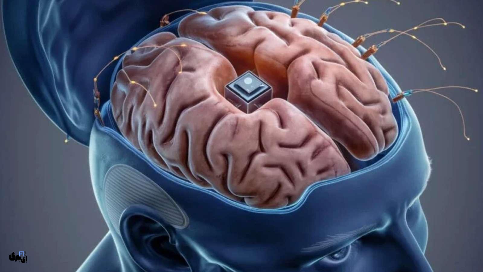 تحول شگفتانگیز FDA: از تراشه مغزی با هوش مصنوعی تا نوآوریهای جدید! 2 راشههای مغزی با هوش مصنوعی توانستهاند به افراد مبتلا به بیماریهای جدی کمک کنند