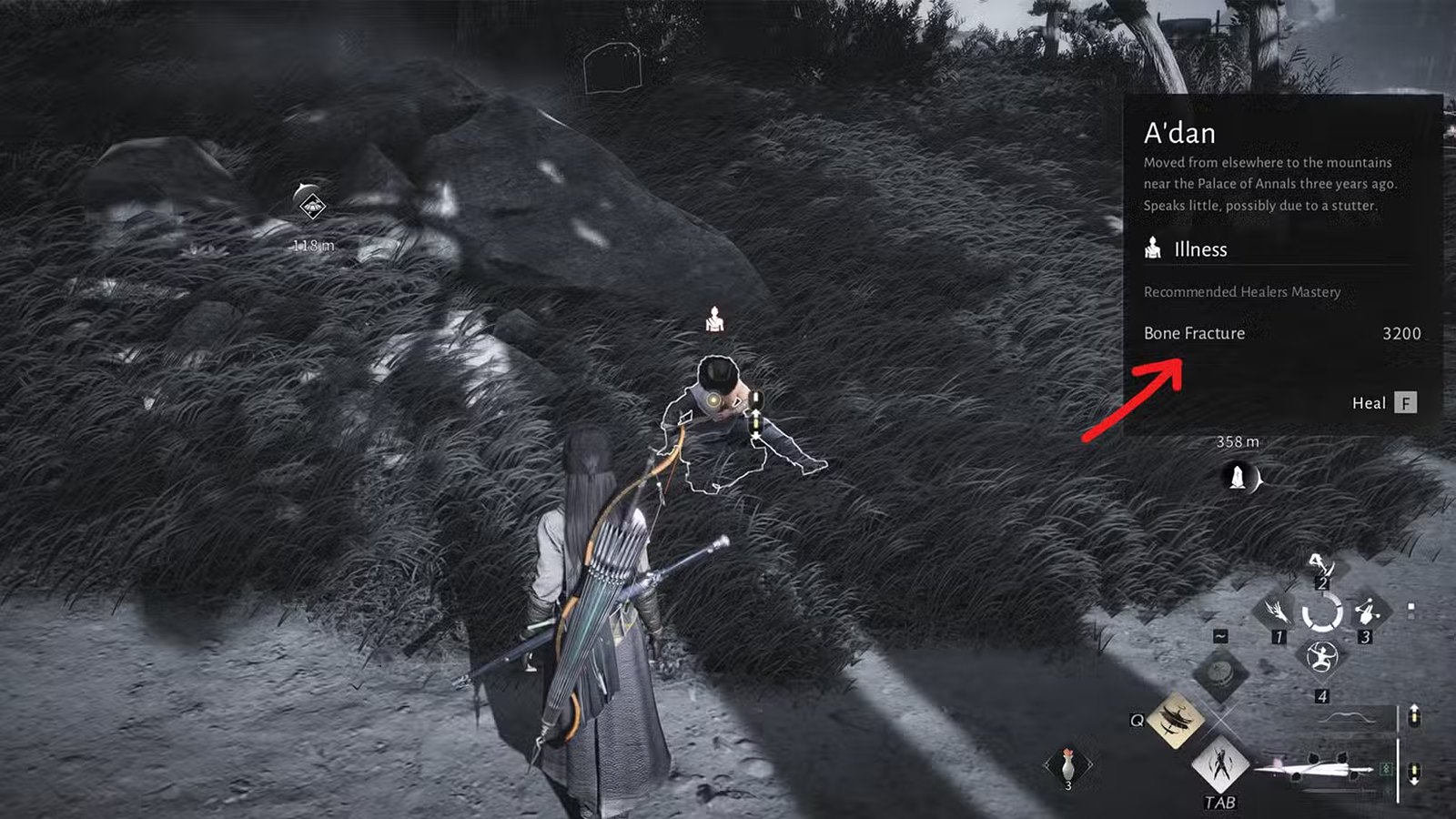 راهنمای حرفه درمانگری در Where Winds Meet 9 راه های درمانگری در Where Winds Meet - تشخیص بیماری با Wind Sense
روش های درمانگری در Where Winds Meet
درمان در Where Winds Meet
نسخه های درمانگری در Where Winds Meet